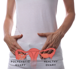 בדיקת העמסת סוכר - תמונת המחשה